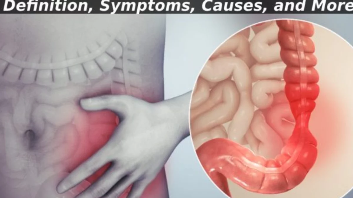 IBS – Definition, Symptoms, Causes, and More