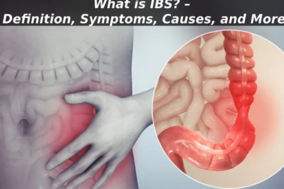 IBS – Definition, Symptoms, Causes, and More
