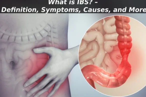 IBS-–-Definition-Symptoms-Causes-and-More